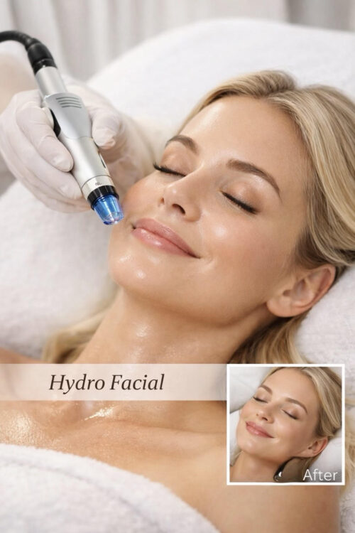 HydraFacial Treatment