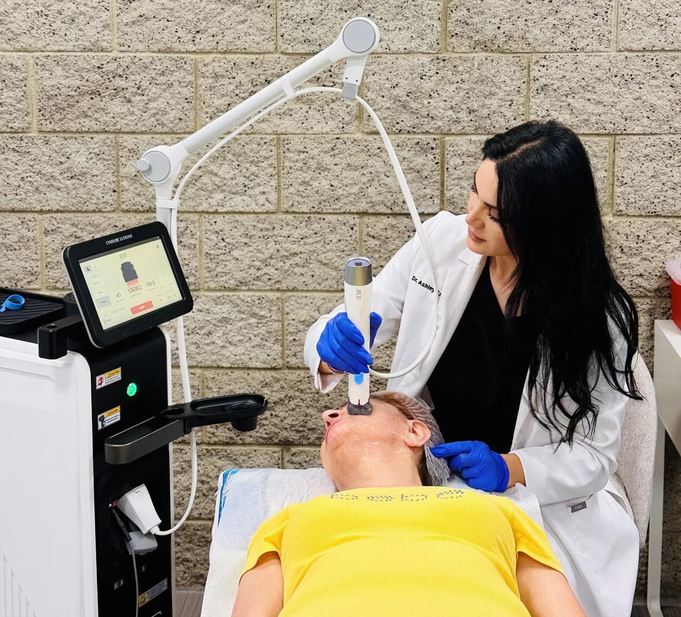 Dr. Ashley Babayan, DNP, performing a XERF radiofrequency skin tightening treatment at Topanga Beauty Center in Canoga Park